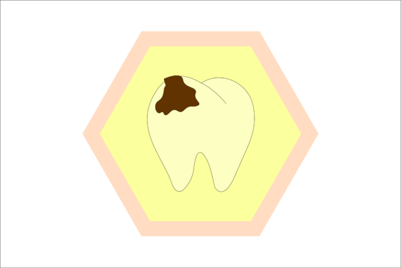 Medical_toothache: A Practical Review for Embroidery Projects